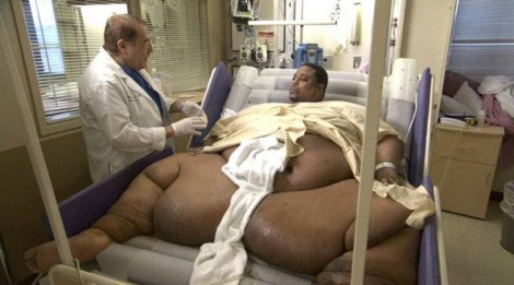 Топ самых толстых людей в мире 1