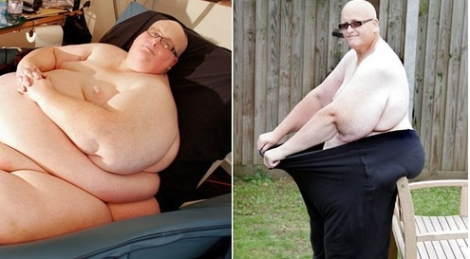 самый толстый мужчина в мире до и после похудения